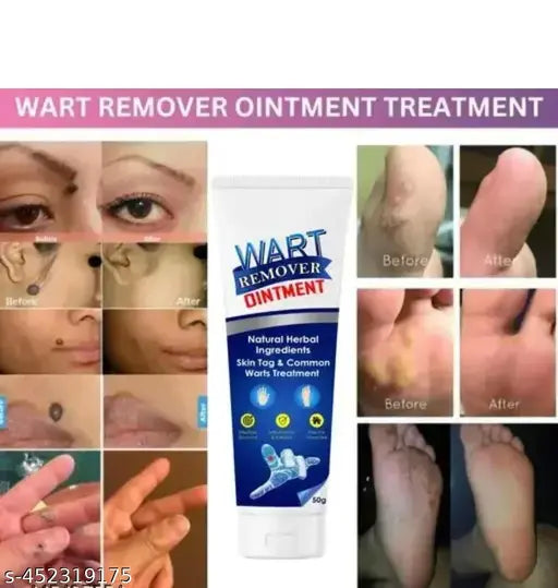 Wart-Remover™ 20ml